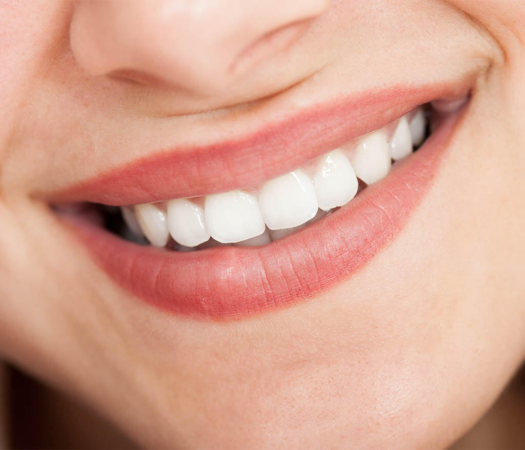 Therasmile Whitening Benefits in Beverly Hills Area
